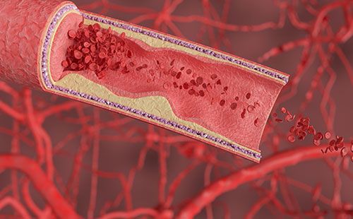 動(dòng)脈硬化檢測(cè)儀